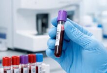 پشت پرده آزمایش‌های پزشکی؛ مواد شیمیایی چگونه سلامت ما را تضمین می‌کنند؟