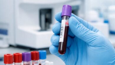 پشت پرده آزمایشهای پزشکی؛ مواد شیمیایی چگونه سلامت ما را تضمین میکنند؟